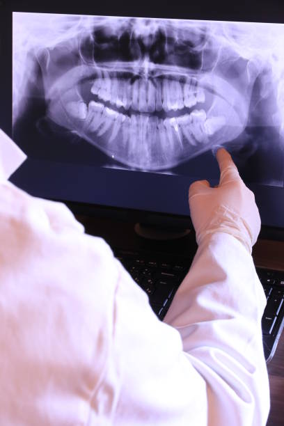 Best Emergency Treatment for Oral Infections in Palmer Lake, CO