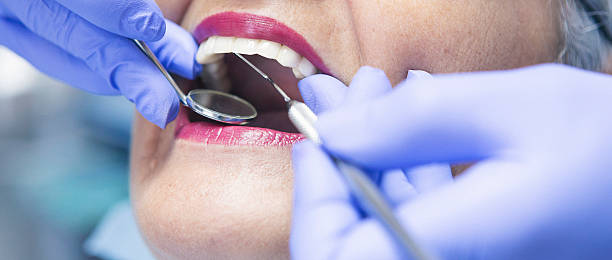 Best Emergency Dental Care for Sports Injuries in Palmer Lake, CO